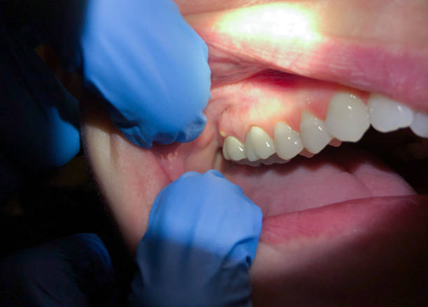 Best Orthodontic Emergency Dentist in Moundville, AL